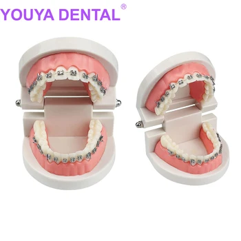 Стоматологическая Ортодонтическая модель Typodont с металлическим кронштейном Arch Wire Стоматологическая Ортодонтическая модель зубов для демонстрации у стоматолога